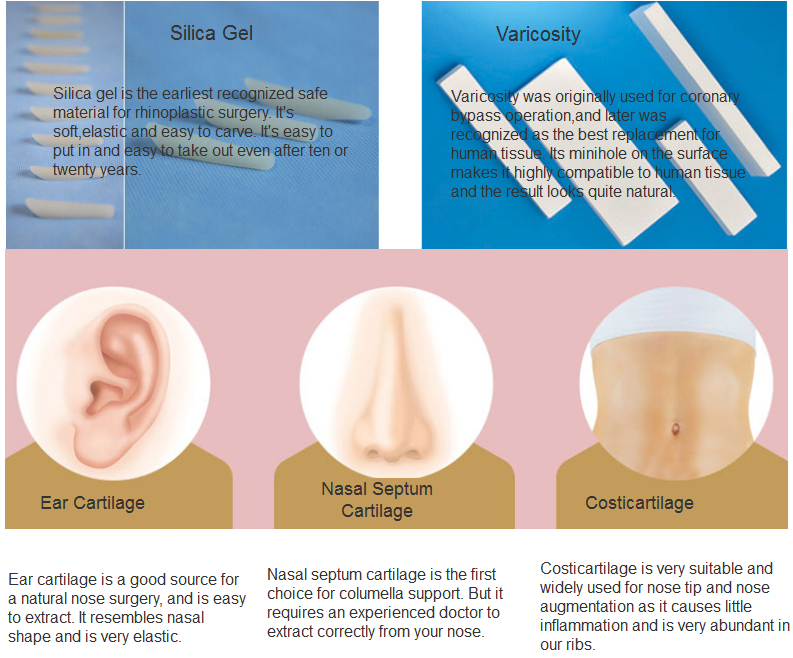 cleft lip revision