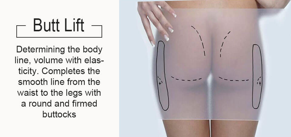 butt lift